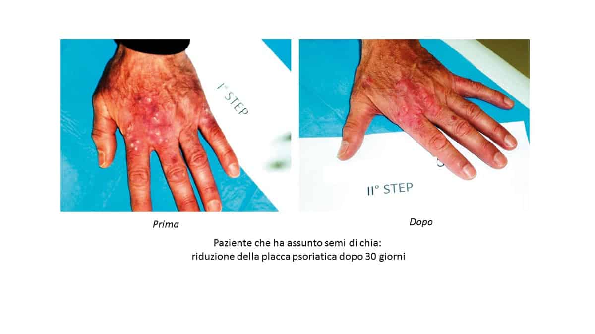 informareonline-i-semi-di-chia