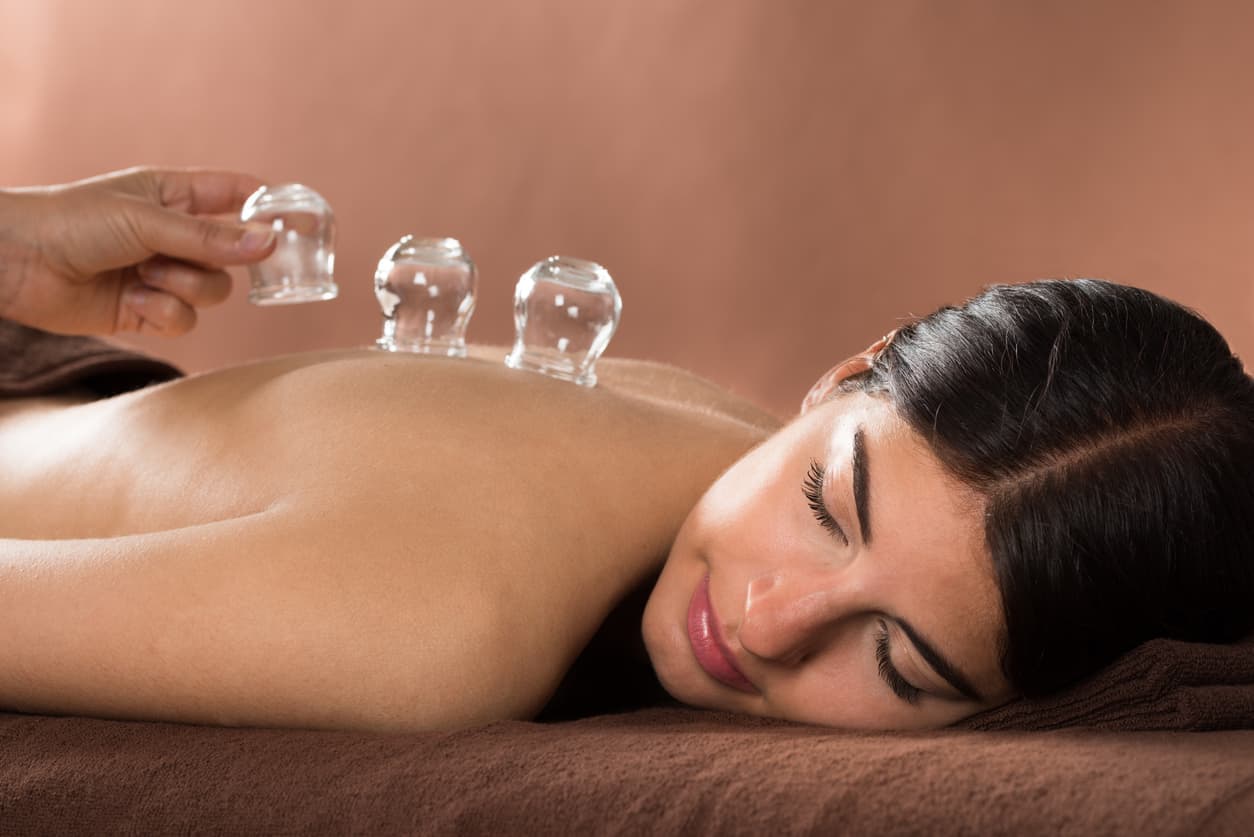 informareonline_contrattura_cupping