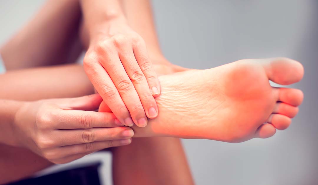 Fascite Plantare: cause, sintomi e rimedi veloci