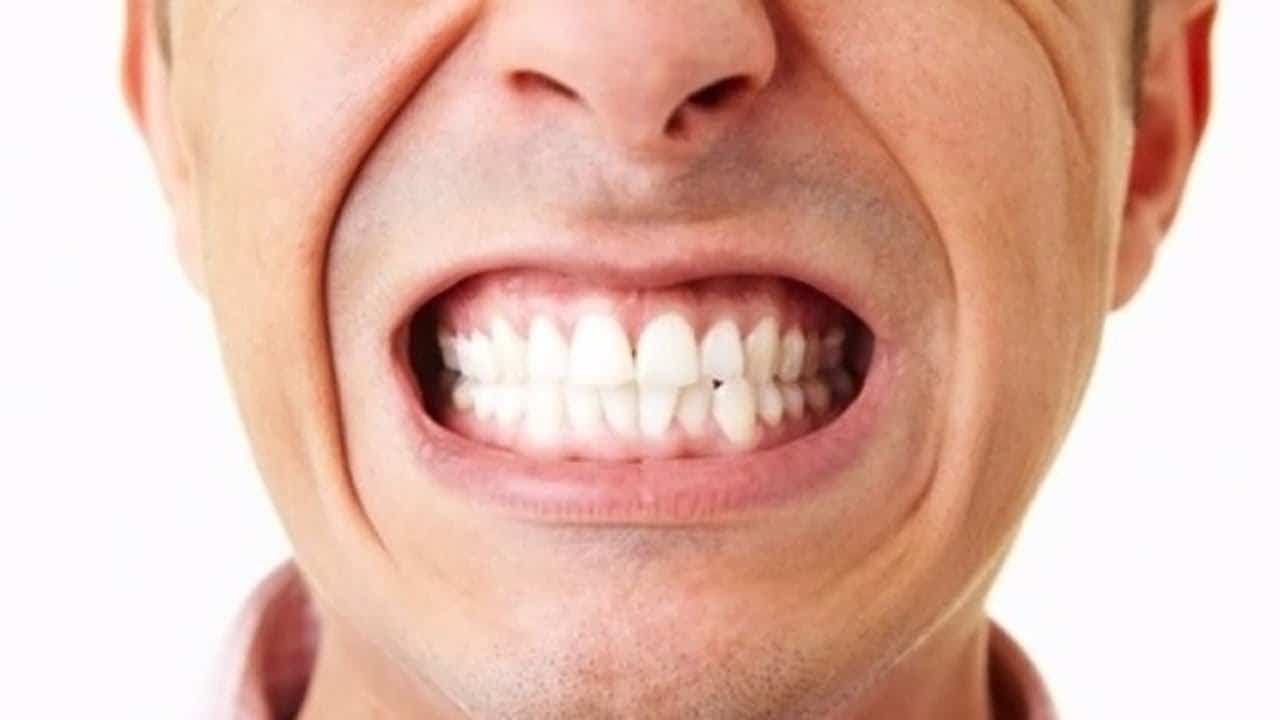 Informareonline-Bruxismo