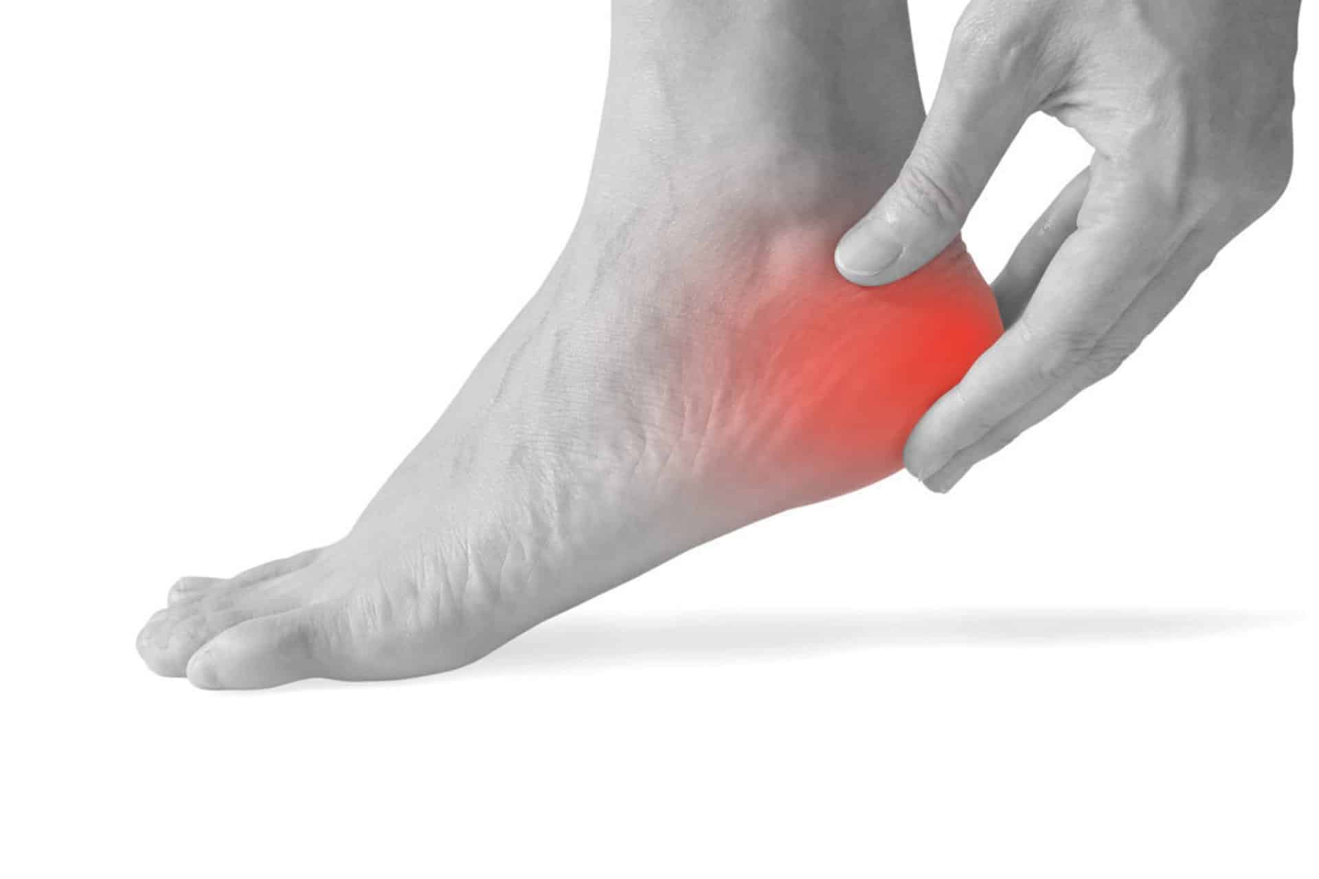Informareonline-Spina-calcaneare