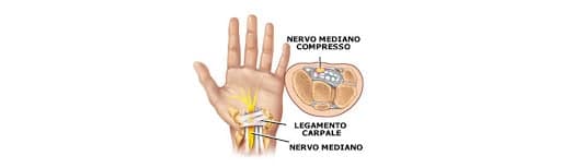 Immagine articolo