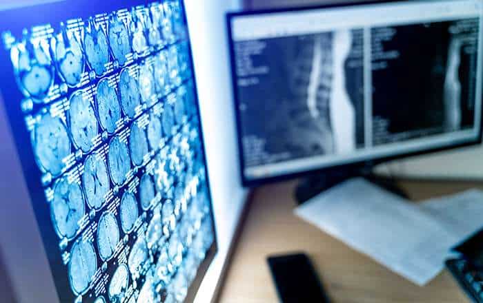 Congresso internazionale di Radiologia a Napoli