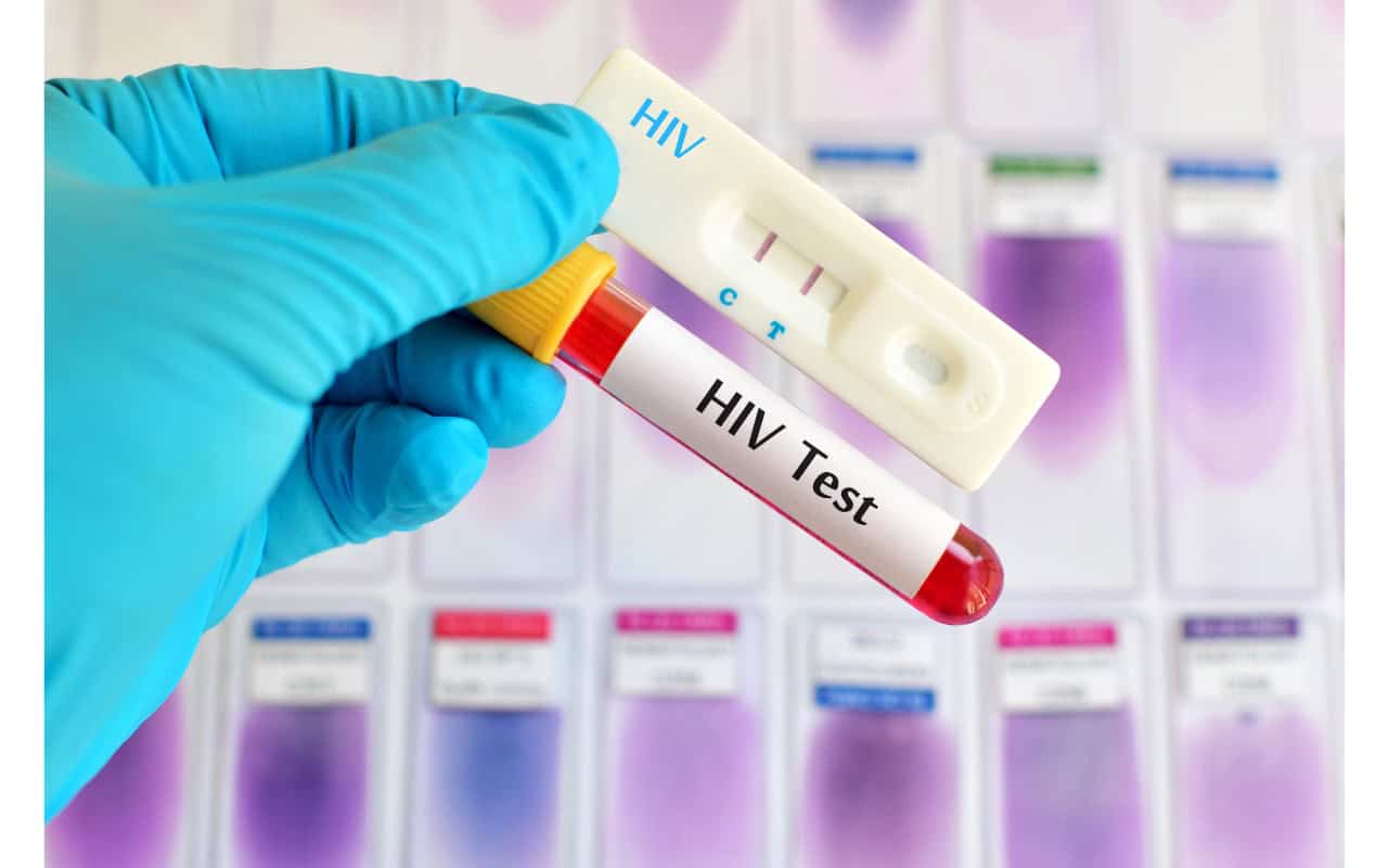 ISS: aumento esponenziale dei casi di HIV in Campania