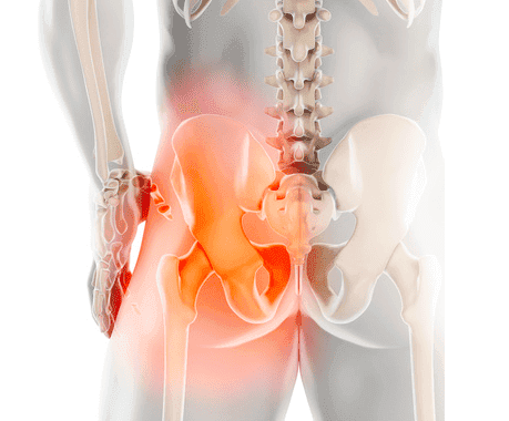 Informareonline-Pubalgia