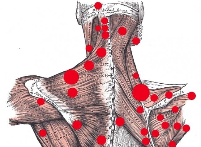 informareonline-trigger-points