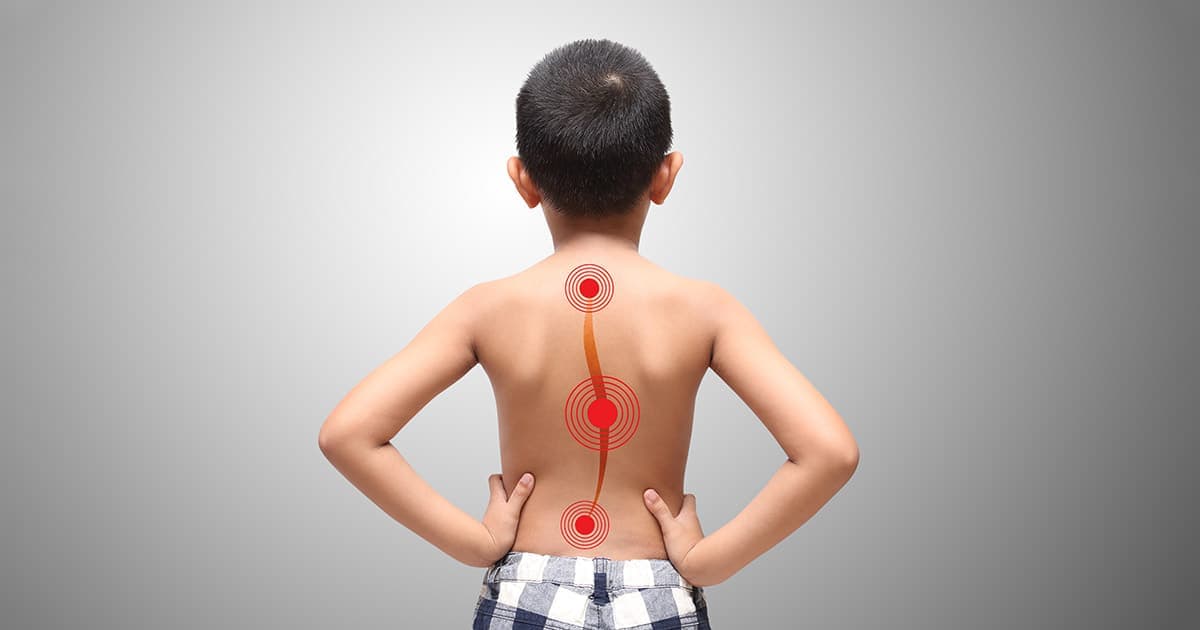 Postura in età pediatrica: i consigli da seguire a scuola e a casa