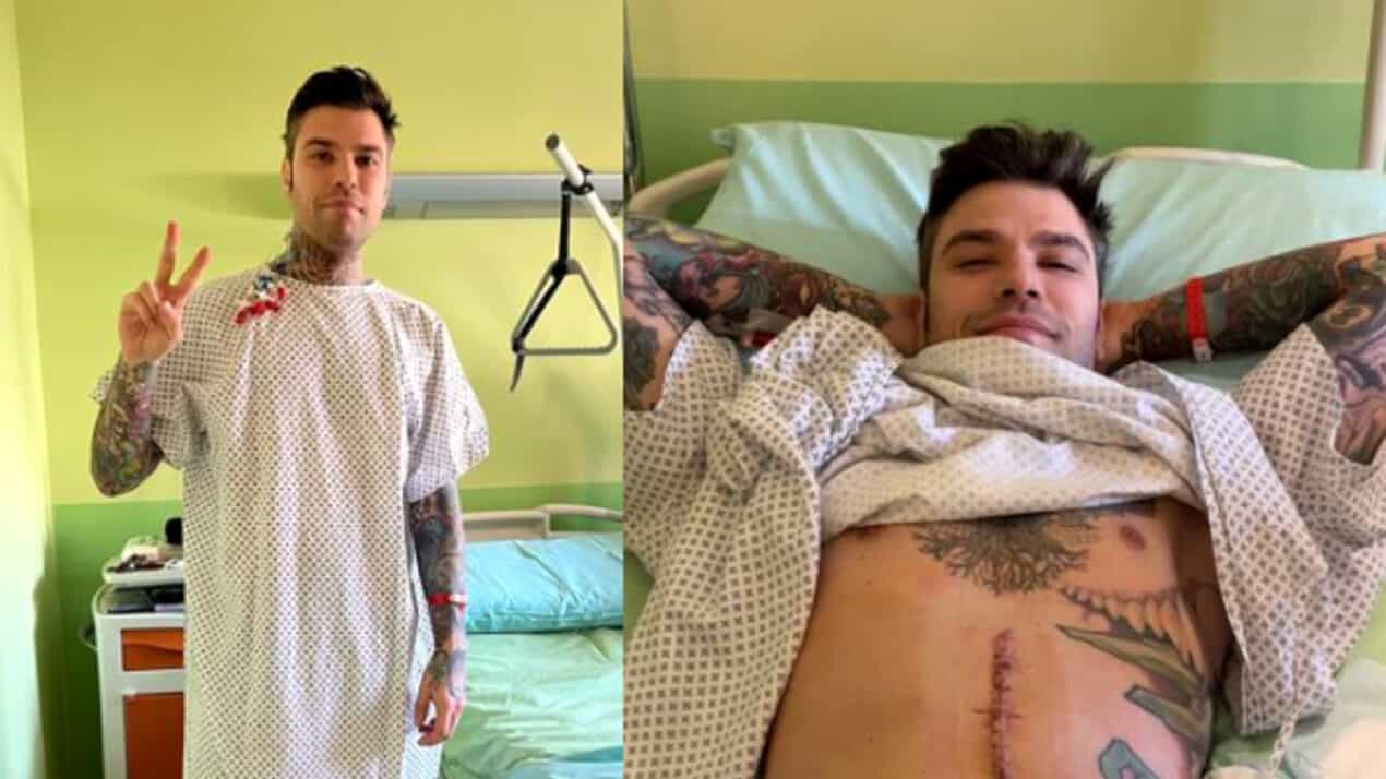 Intervento riuscito per Fedez, asportata una parte del pancreas