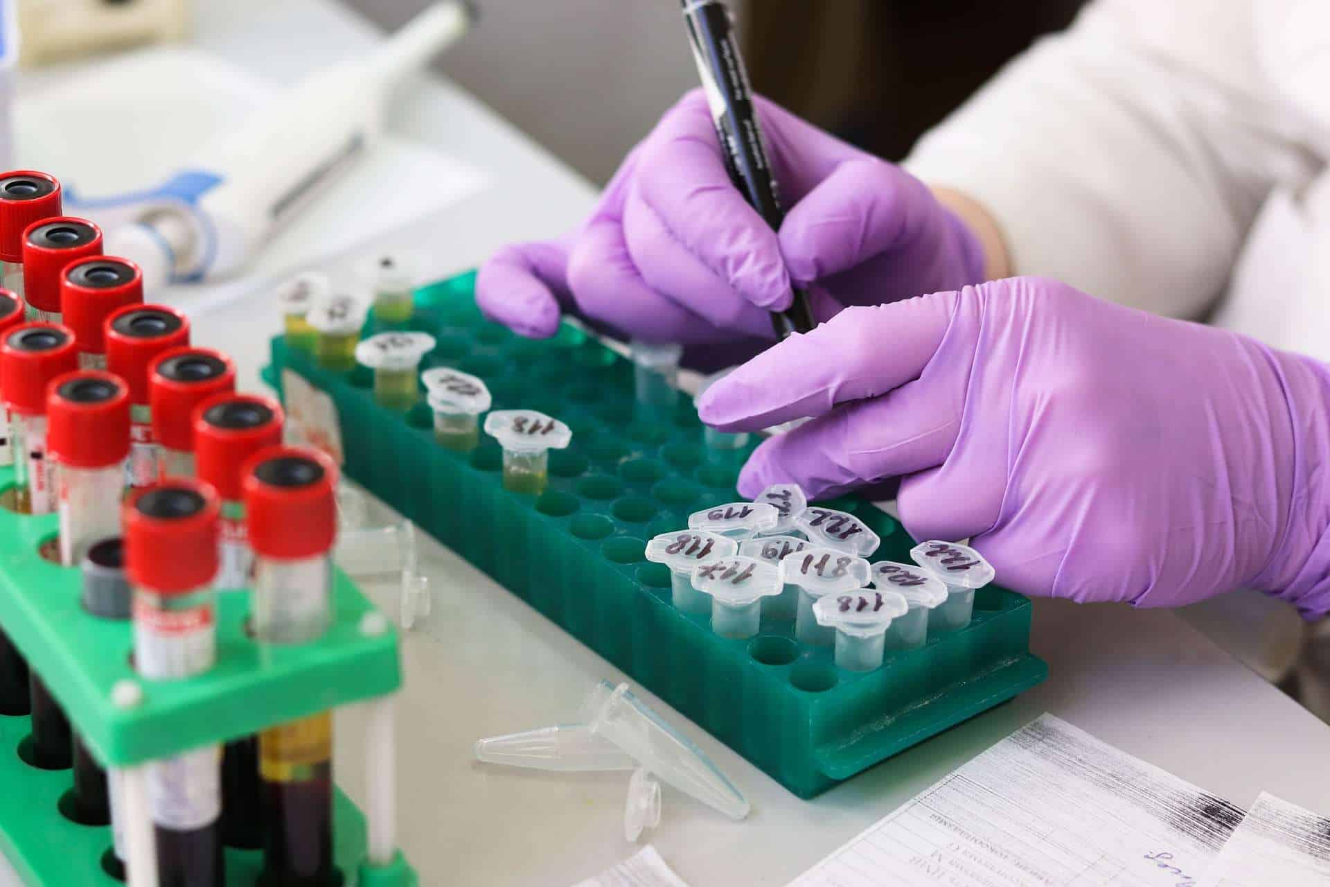 Asl Caserta: radiologia e laboratori attivi anche nei weekend