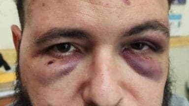 Indossa giubbino "Antifa" e viene aggredito: rinviati a giudizio i responsabili