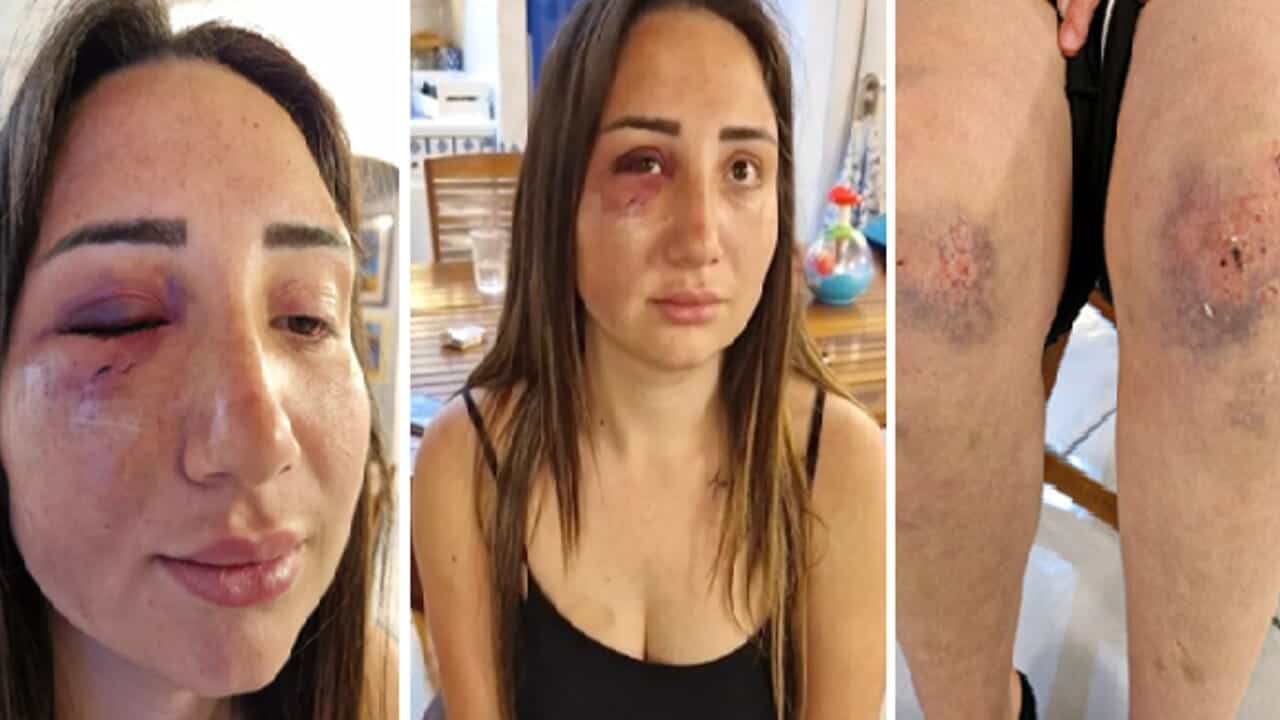 Gaia, donna aggredita e quasi uccisa da tre uomini a Pozzuoli