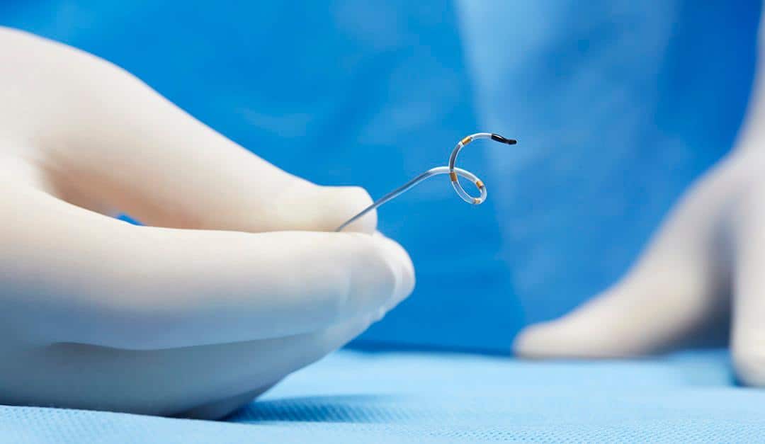 Ospedale di Caserta: trattamento innovativo per i pazienti con ipertensione resistente
